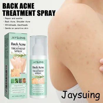 10 best sales Sırt sivilce spreyi - №5