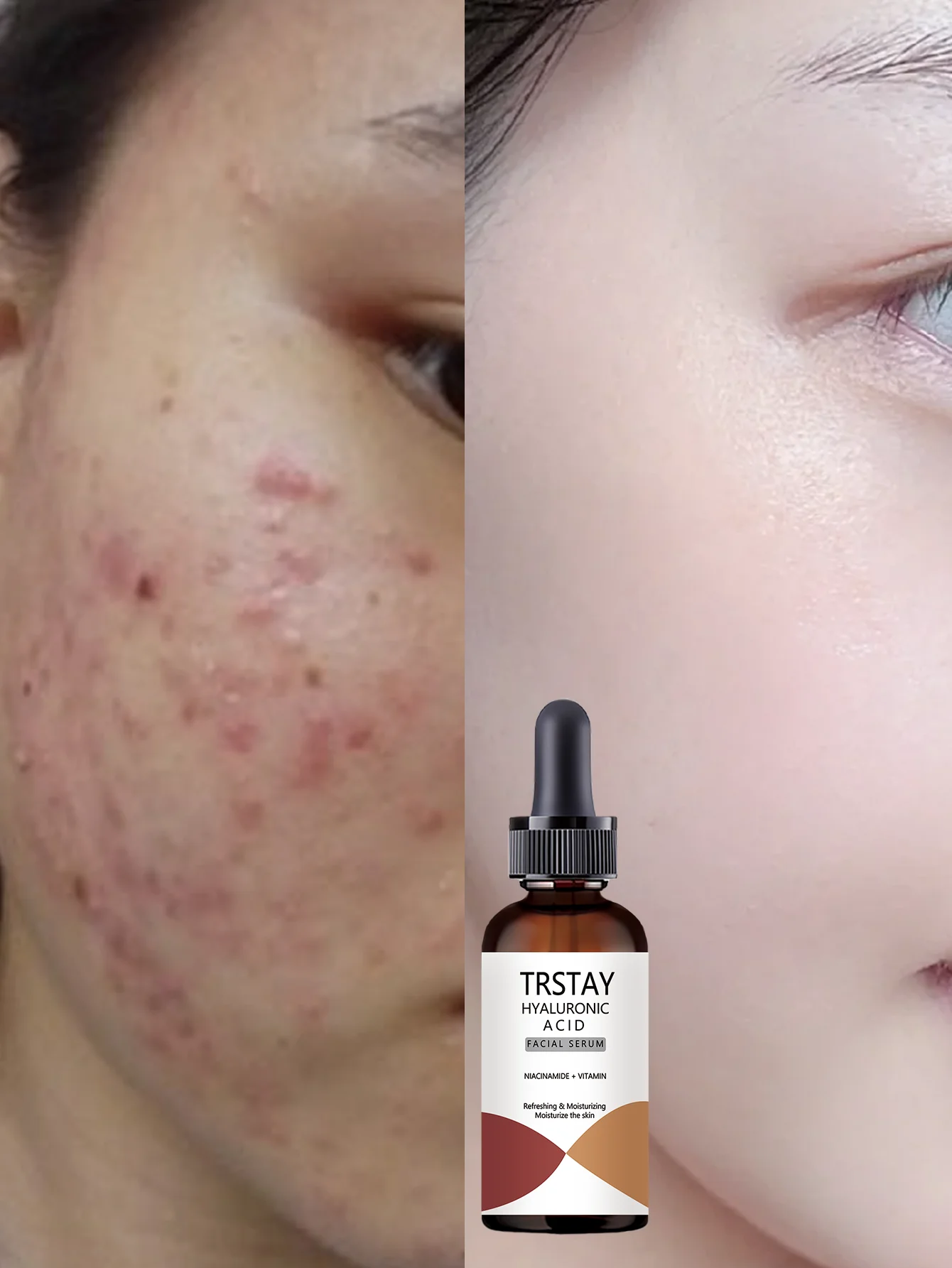 Hydrating Facial Oil for Daily Moisture Boost with Natural Ingredients for Deep Nourishment and Radiant Skin All Day Long