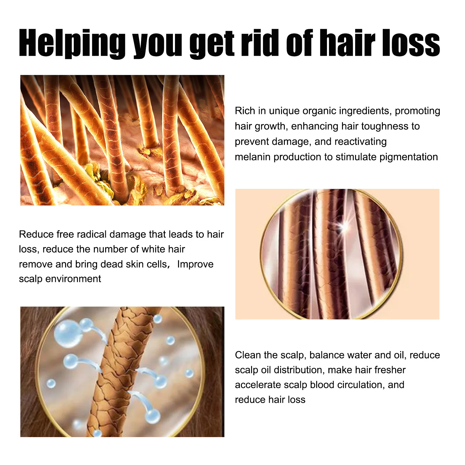 30 مللي جوهر شعر رجالي من East Moon مكمل قوي ومتين ومرطب مغذي يمنع السقوط حل العناية بالشعر الكثيف القابل للتصت