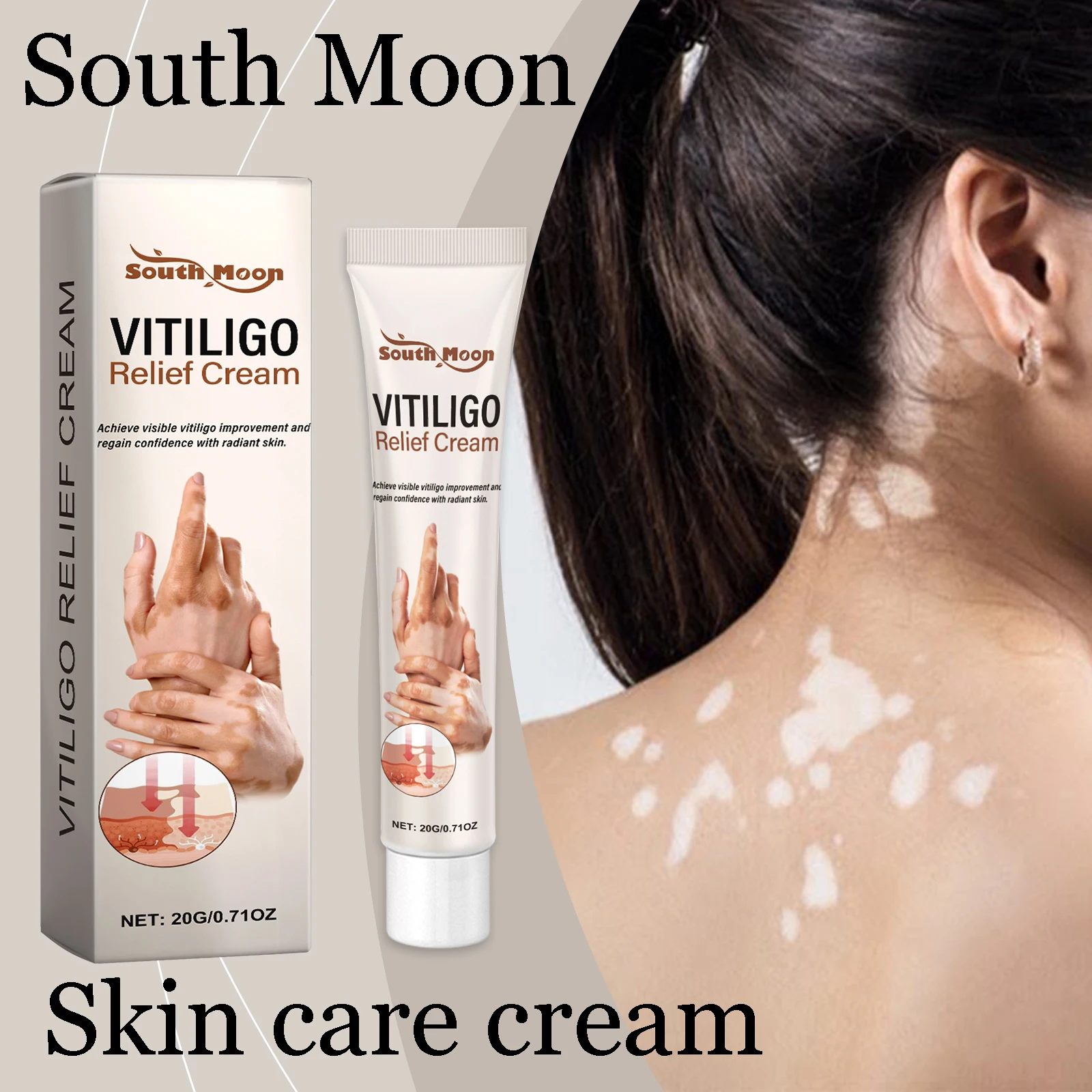 

Крем для ухода за витилиго в Южной Луне, облегчающий зуда, питательный, уменьшает отеки, способствует здоровью кожи, увлажняющий, успокаивающий крем для тела