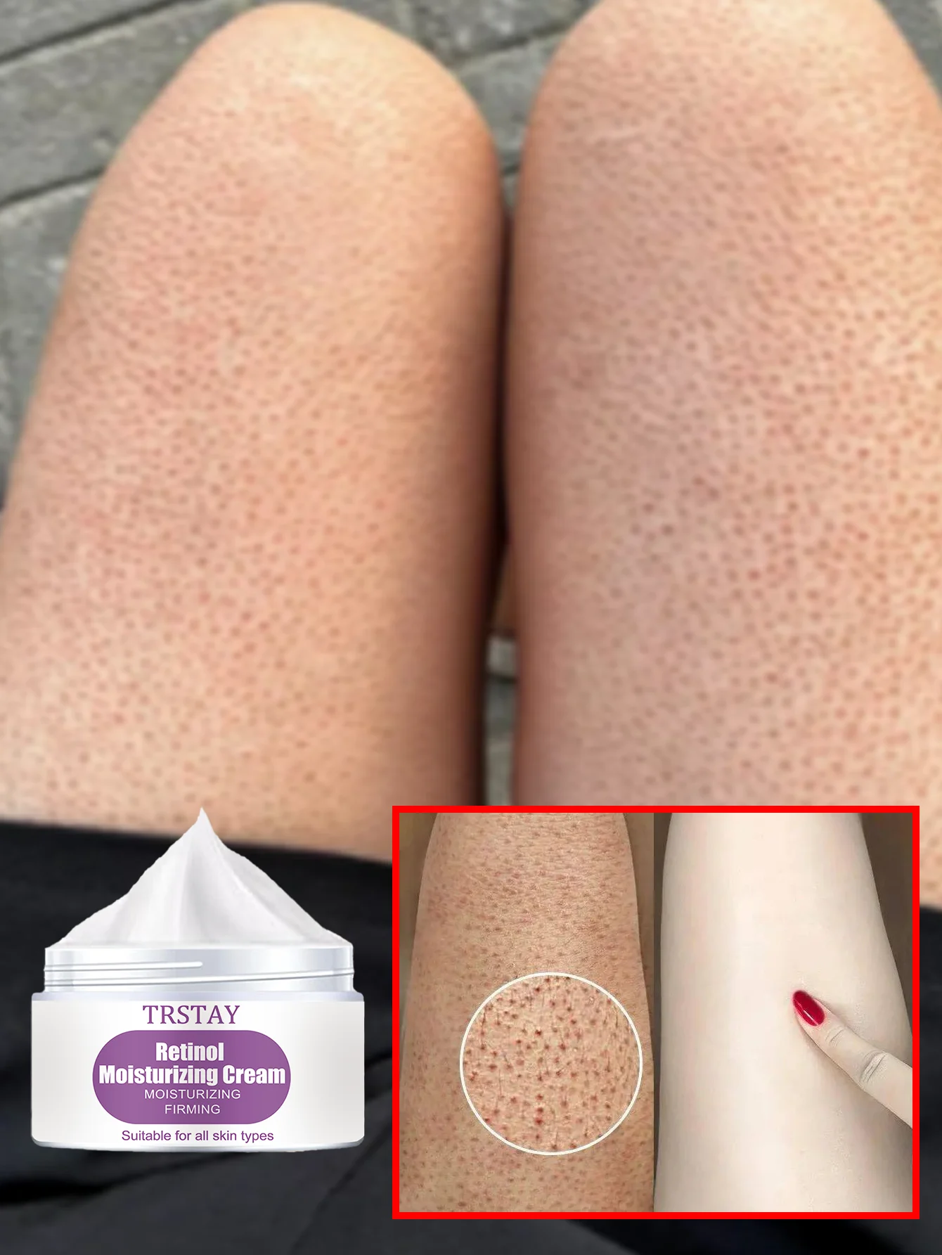 

Питательный крем для тела с витамином Е для осветления кожи, глубокое увлажнение и смягчение, идеальный уход за кожей, увлажнение для всех