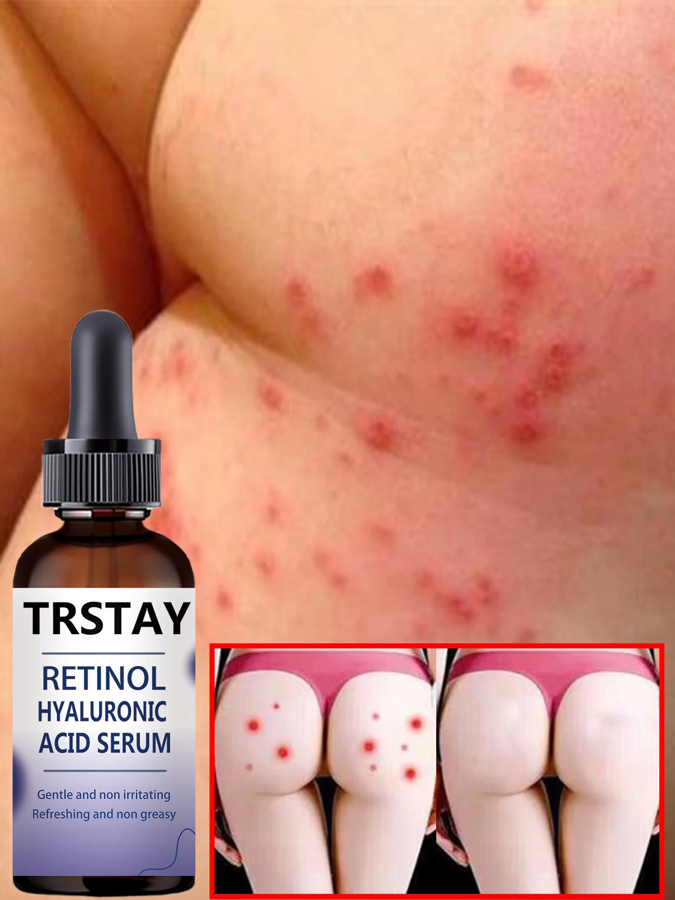 

Hydrating Anti Wrinkle Double Extract Essence Fades Spots Nourishes Porcelain White Skin for Youthful Glow with Anti Aging Formu