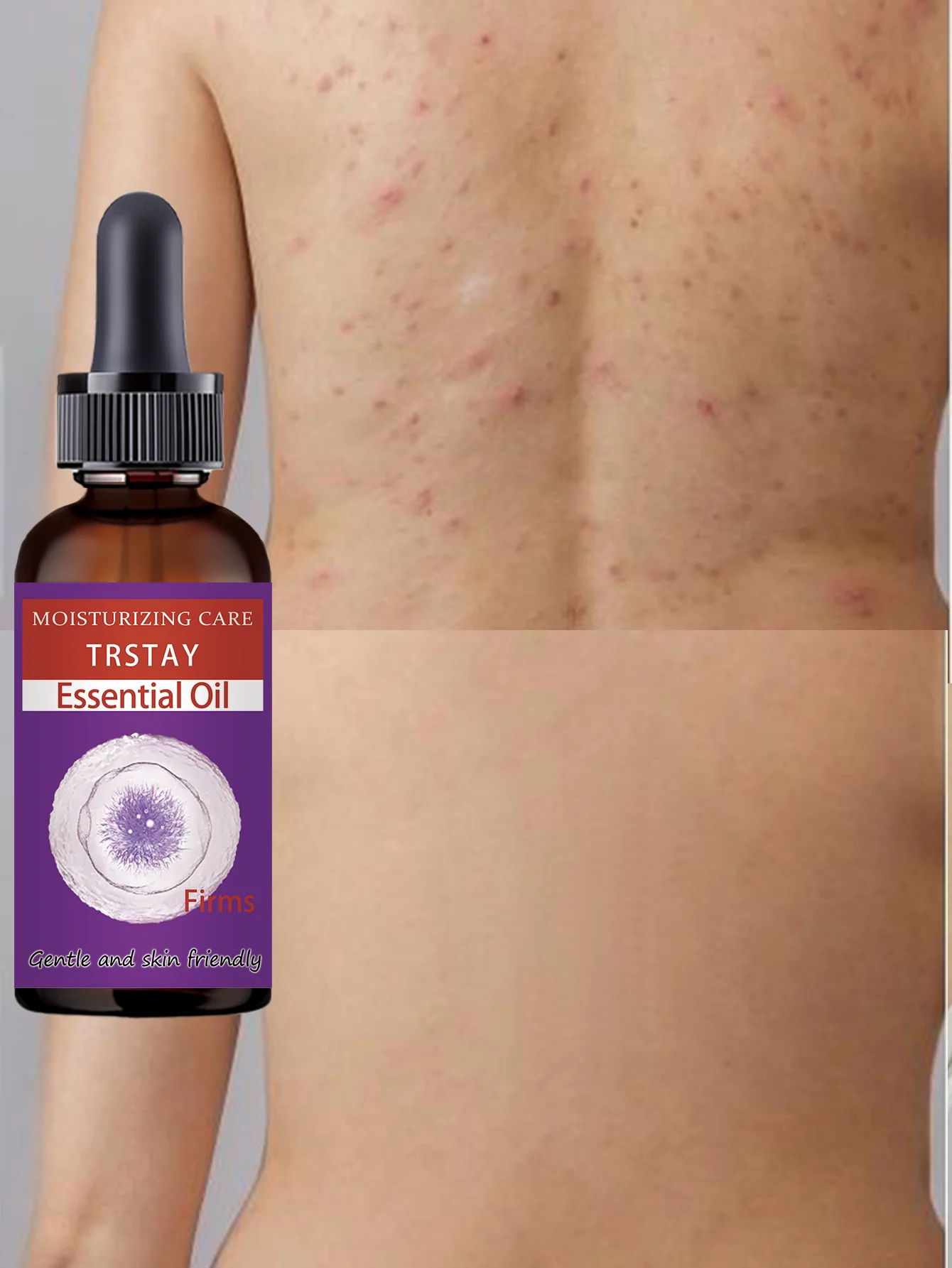 

Moisturizing Brightening Body Oil with Vitamin E Deep Hydration Nourishes Skin for a Healthy Glow Perfect for Dry Skin Care Rout