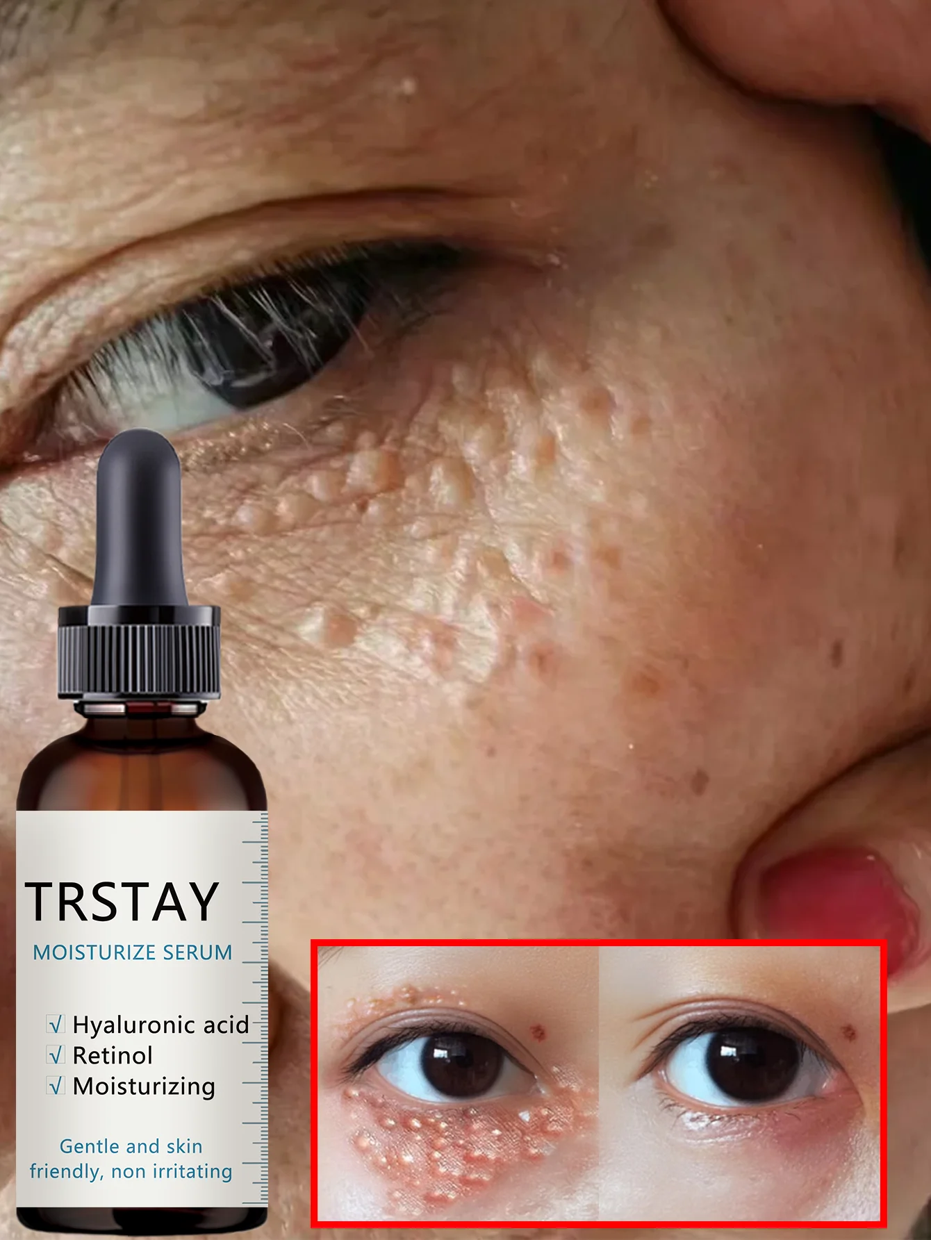 Eye Brightening Moisturizing Oil for Dark Circles All Skin Types Hydrating Under Eye Treatment with Natural Ingredients to Reduc - Image 5