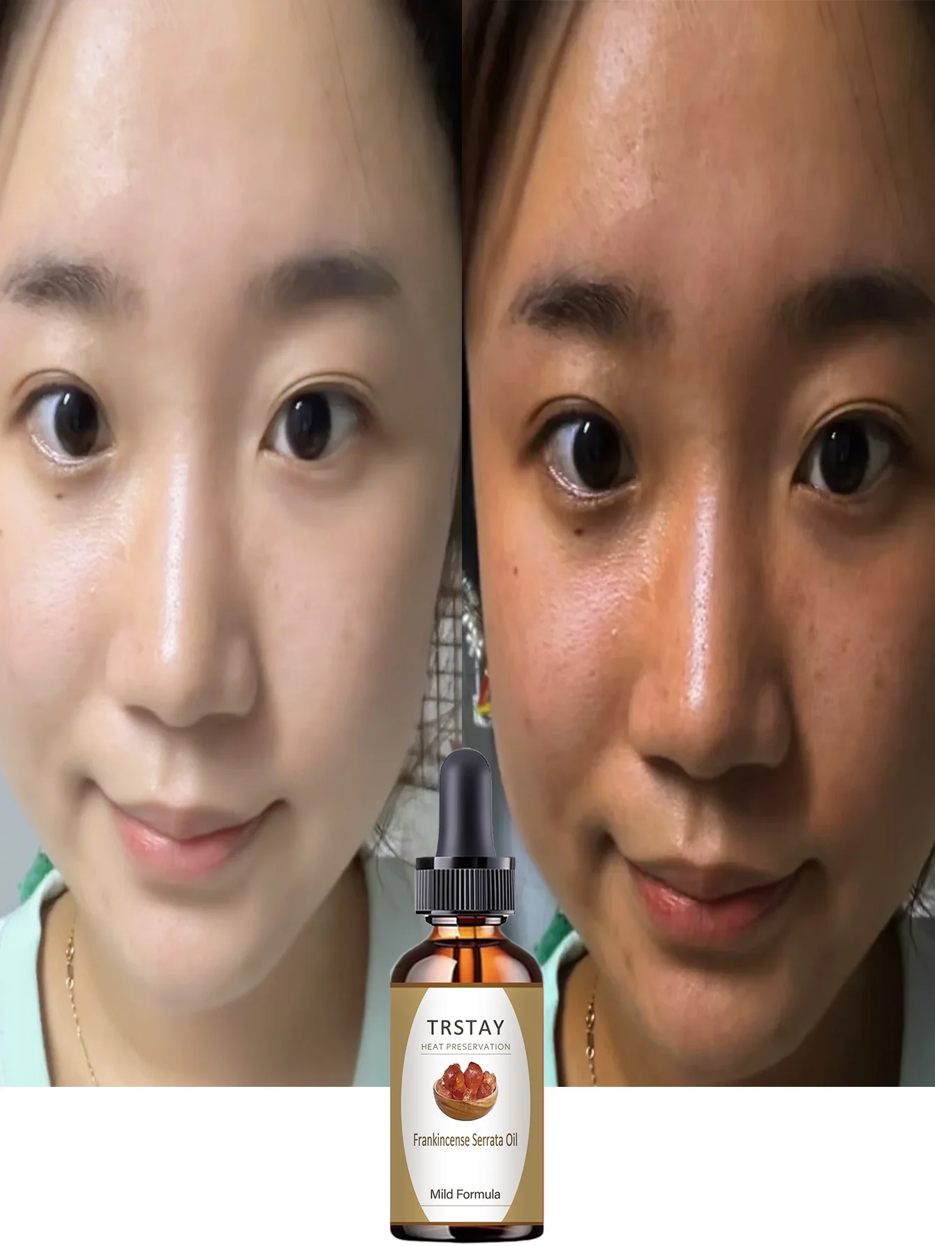 Hydrating Fast Penetrating Facial Oil with Natural Extracts for Deep Moisture and Instant Brightening Suitable for All Skin Type - Image 6