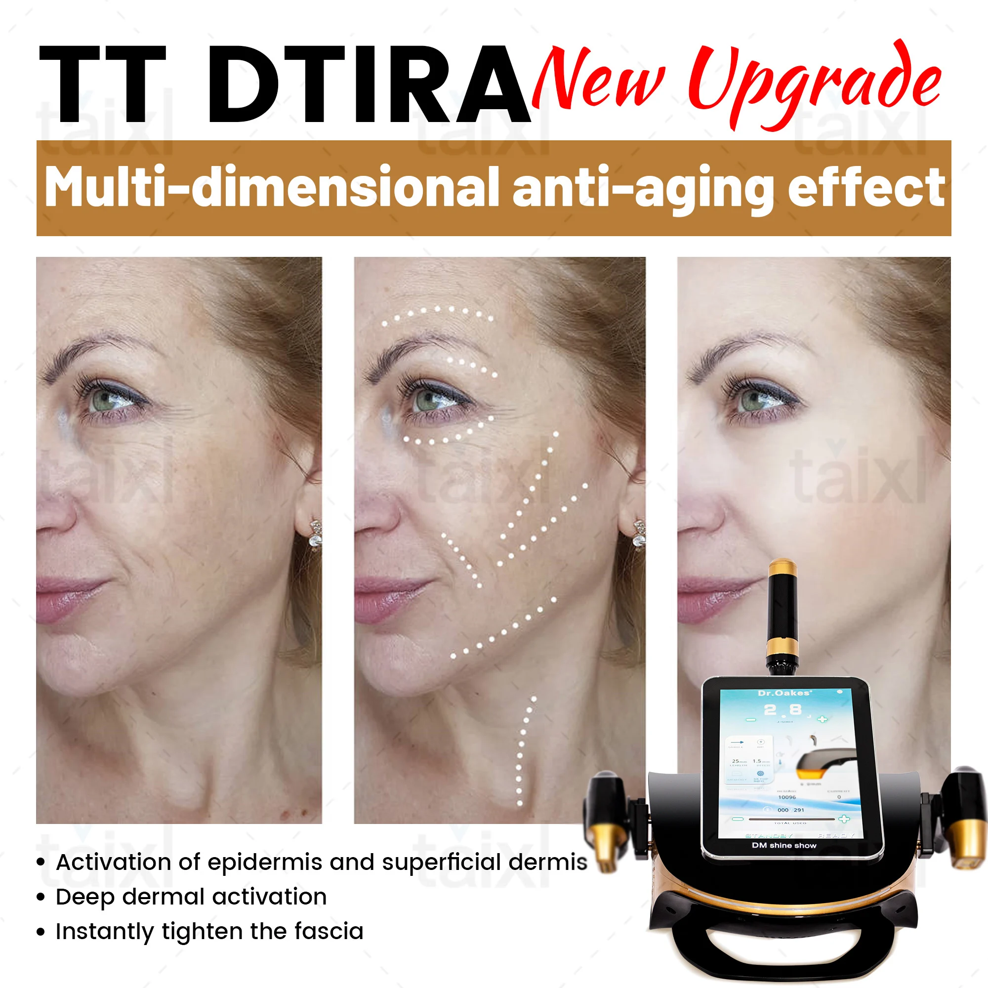 

Профессиональный портативный аппарат 13,3 дюйма TT с двойным лифтингом для подтяжки лица, коррекции фигуры, омоложения и укрепления кожи