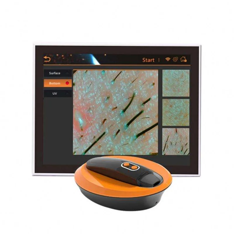 AI Smart 3D Skin Hair Scalp Analyzer Portable Desktop Acne Pigmentation Wrinkle Diagnosis Detector With Report Printing