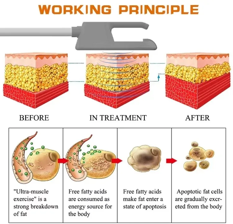 

Профессиональный аппарат Mysolim для коррекции фигуры с RF-лифтингом и электромагнитной стимуляцией мышц, оборудование для SPA-процедур и похудения