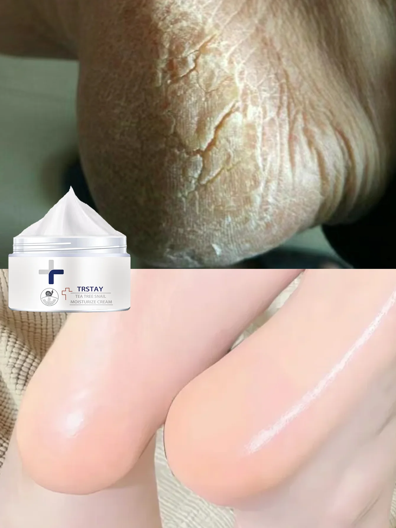 

Быстрое восстановление, увлажняющий крем для ног, успокаивает сухость, зуд, покраснение и перхоть, освежающая нелипкая формула для мгновенного обновления