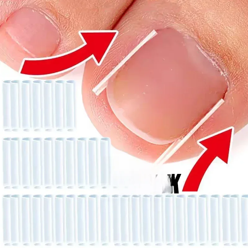 Coussinet tubulaire élastique en forme de C pour les ongles incarnés, outils correcteurs, soins des pieds, rainure Invisible, traitement de Clip de redressage