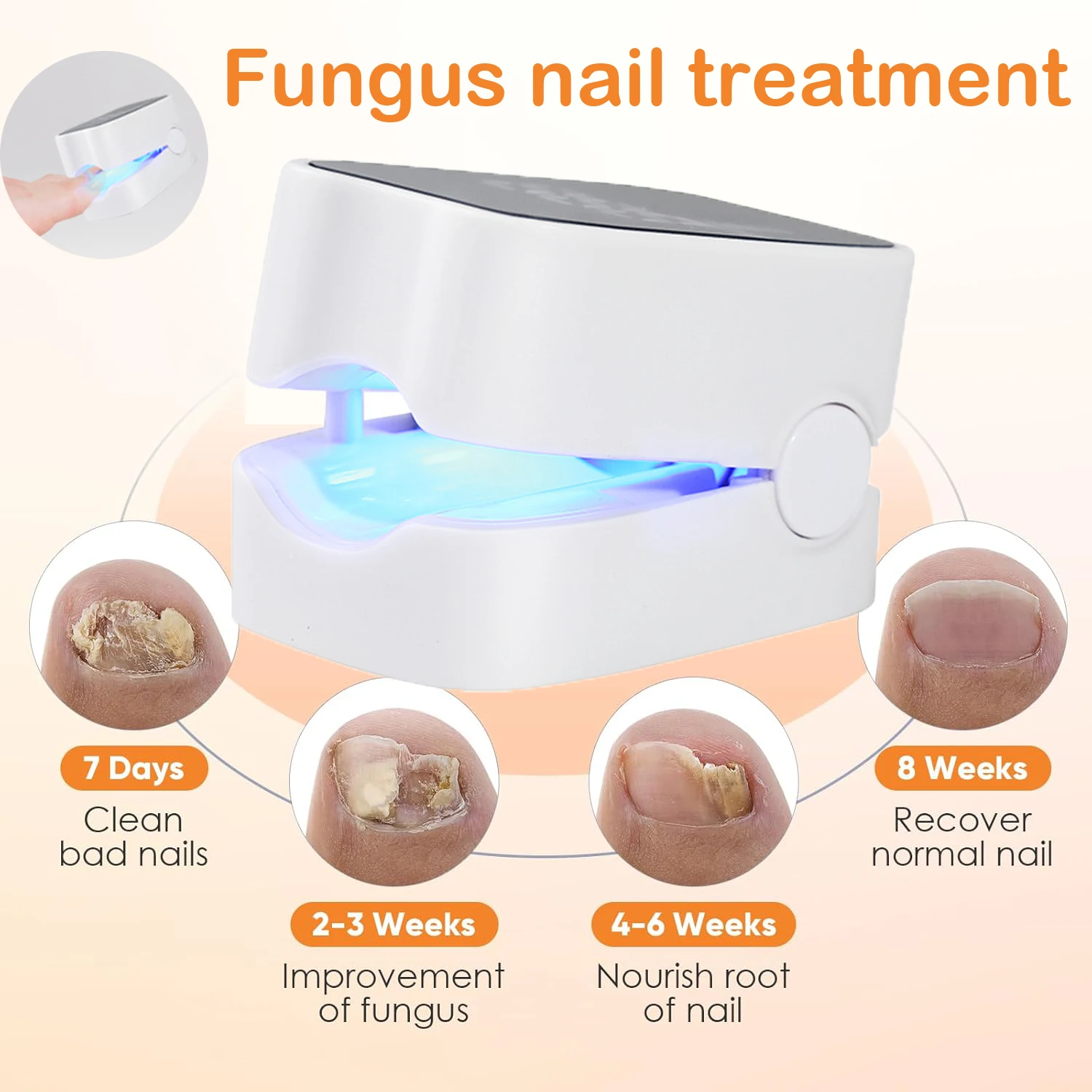 Nail Fungus Device Toenail Laser Therapy Machine Anti Fungal laserEquipment for Repair Fast Onychomycosis 905nm 470nm usb charge