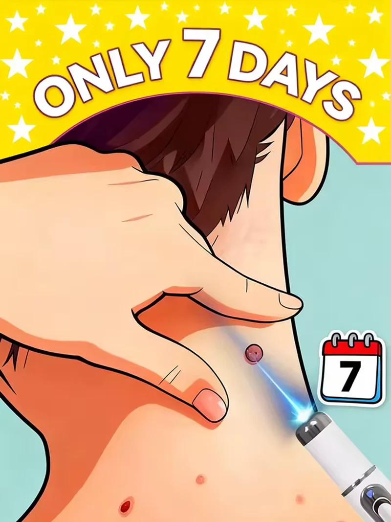 

Blue light pen solve all warts, wart laser tools