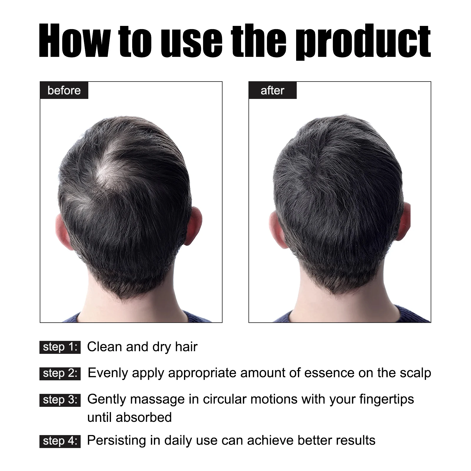 30 مللي جوهر شعر رجالي من East Moon مكمل قوي ومتين ومرطب مغذي يمنع السقوط حل العناية بالشعر الكثيف القابل للتصت