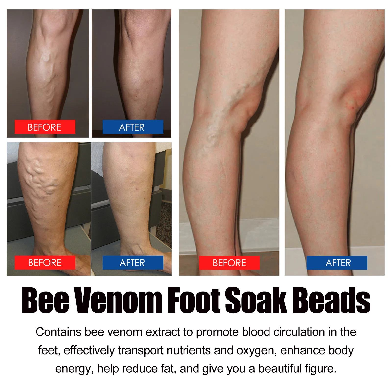 Bee Venom Foot Soak Fat Burning Shaping Relief Varicose Veins Dehumidification Improve Insomnia Anti Fatigue Slimming Foot Care