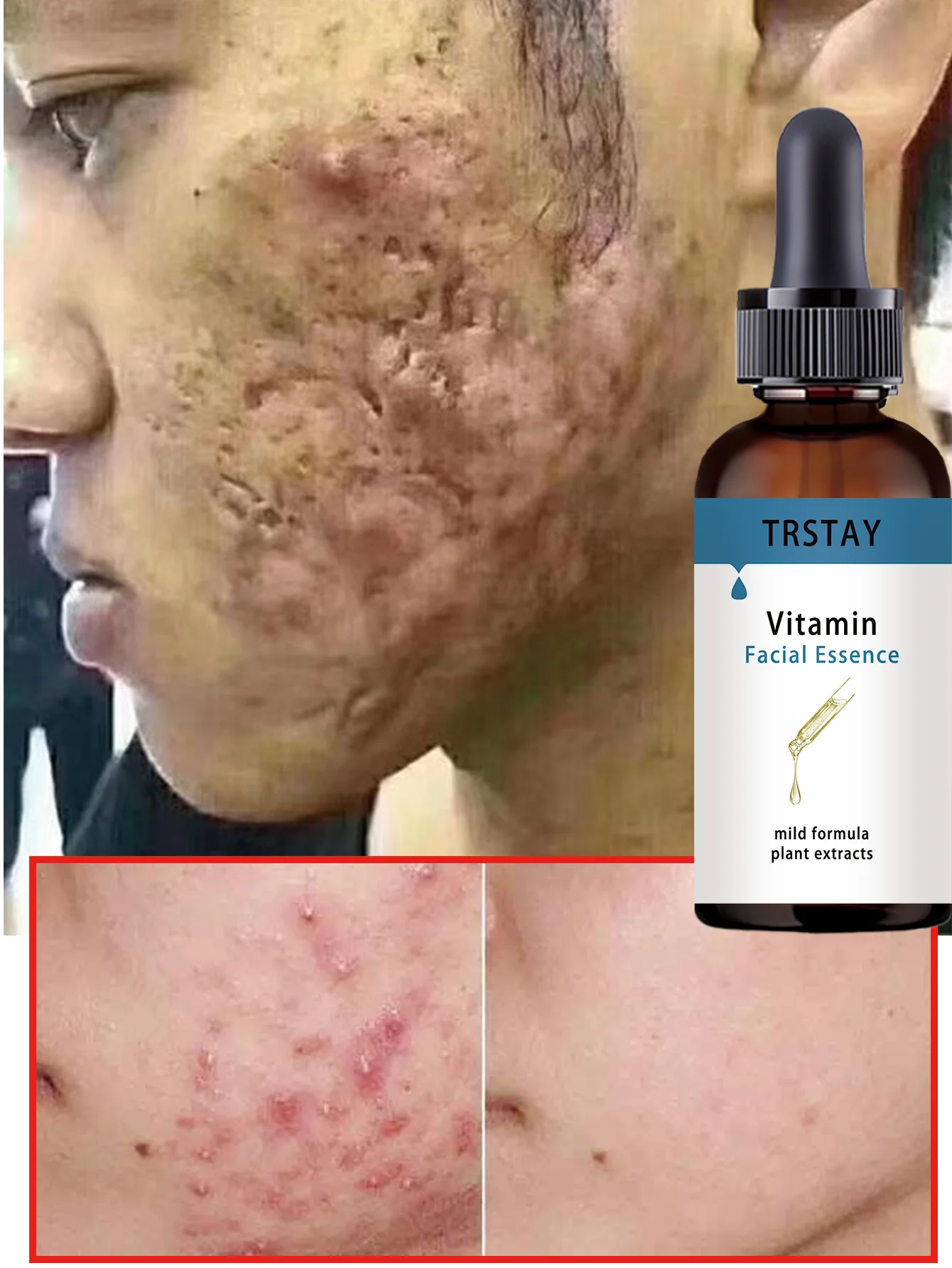 Hydrating Warmth Activated Facial Oil For Better Absorption Deep Moisturizing Serum Nourishing Skin Care Treatment For All Skin - Image 4