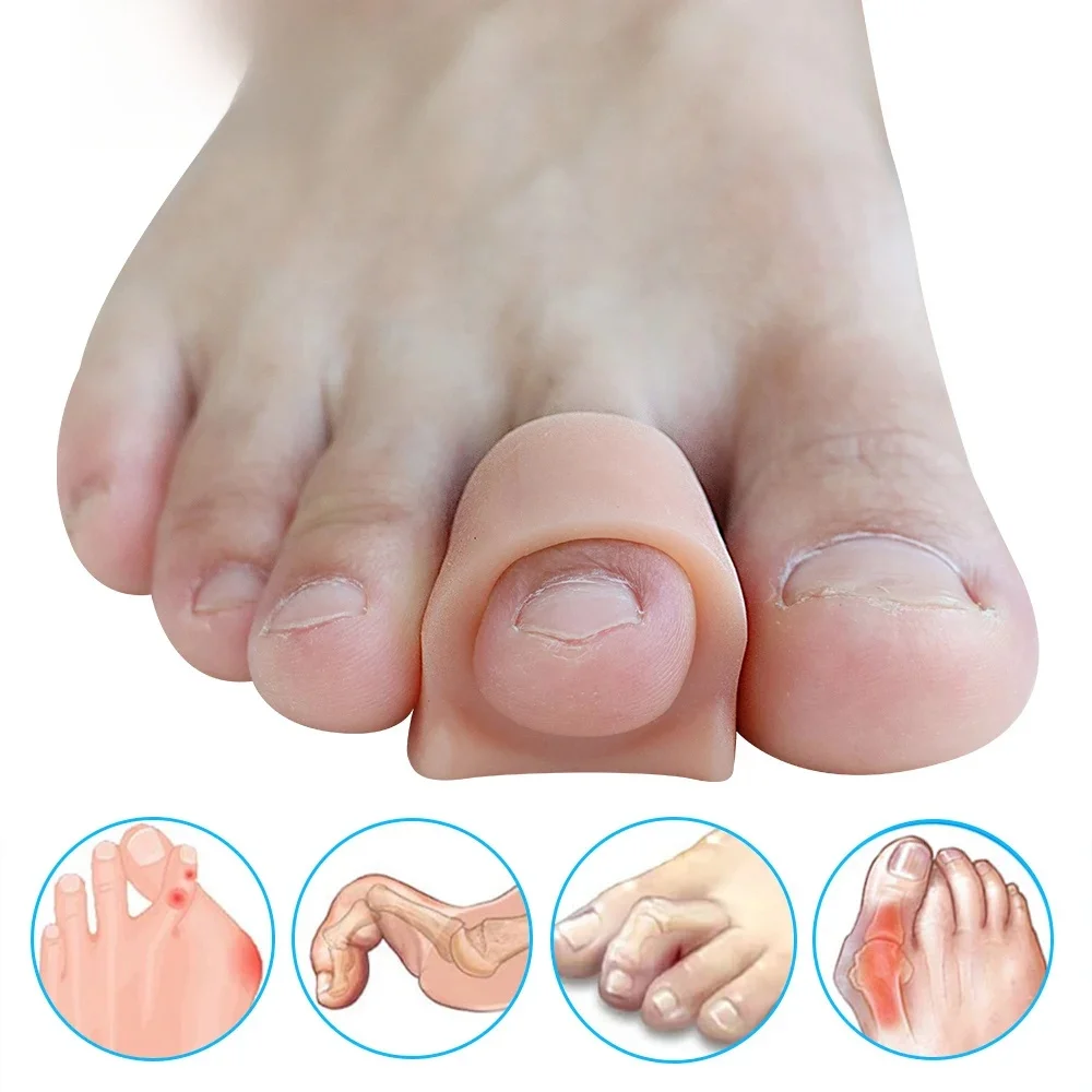 Pexmen 2/4/10 pièces séparateurs d'orteils en Gel souple entretoises d'orteils correcteur d'oignon pour chevauchement Hallux Valgus et marteau orteil outil de soin des pieds