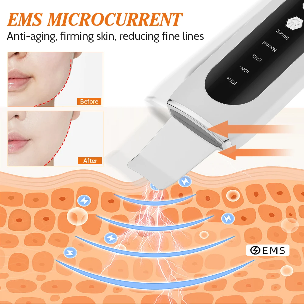 Ultrasonic Face Skin Scrubber Skin Shoveling EMS Micro-current Ion Import Facial Skin Lift Pore Clean Red Blue Light Beauty Tool