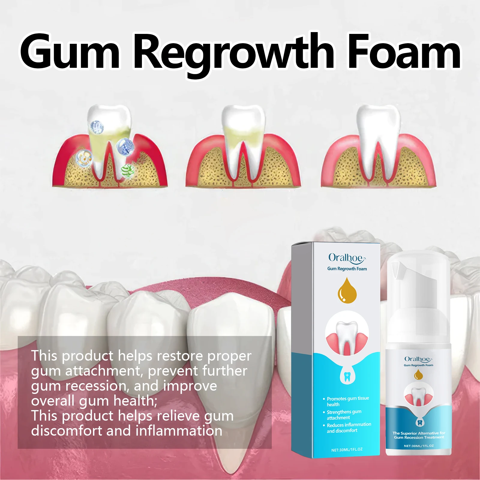 Oralhoe 30 مللي رغوة إعادة نمو اللثة موس معجون الأسنان اشراق إزالة البقع الصفراء تنظيف رائحة الفم الكريهة الطازجة اللثة إصلاح موس