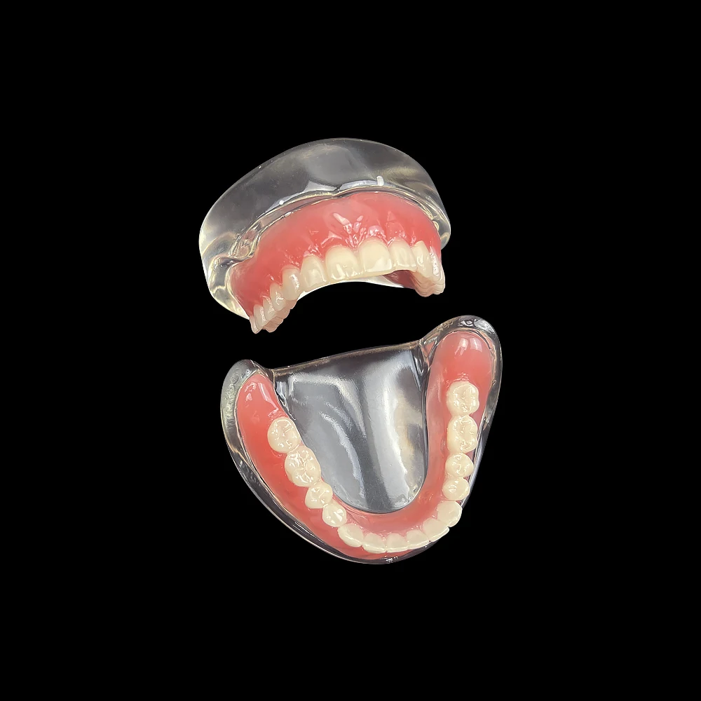 Dentystyczna Overdenture Model zębów lepszy Model demonstracyjny górnej/dolnej szczęki ze zdejmowanym mostkiem 4 implanty, badanie dydaktyczne