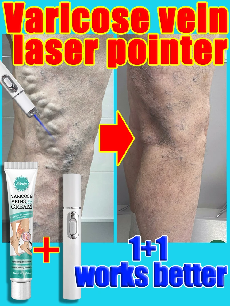 Hot sale Laser Vein