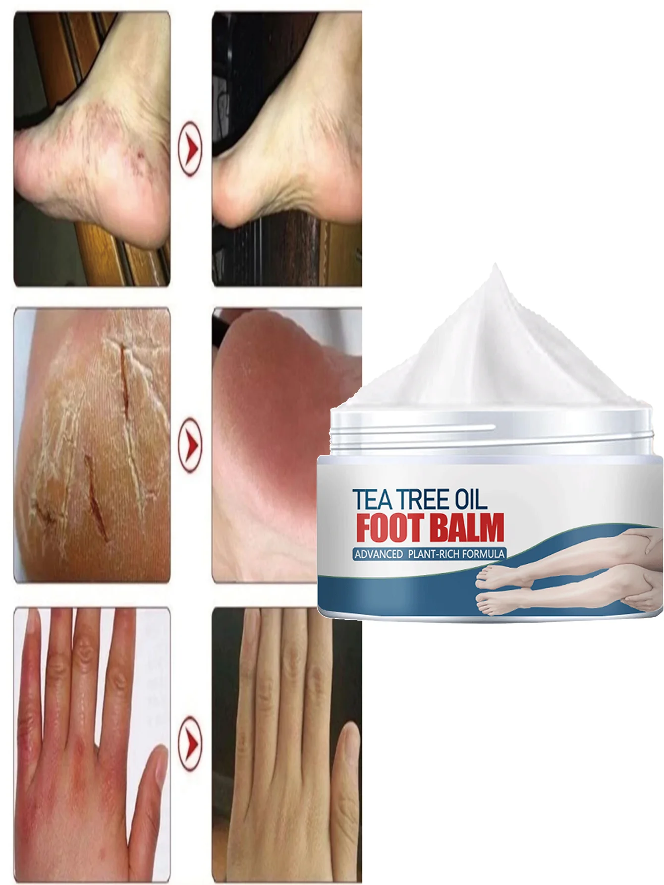 

Moisturizing Foot Cream for Dry Cracked Heels and Calluses Deeply Hydrates Softens Brightens Skin Tone for Silky Smooth Feet