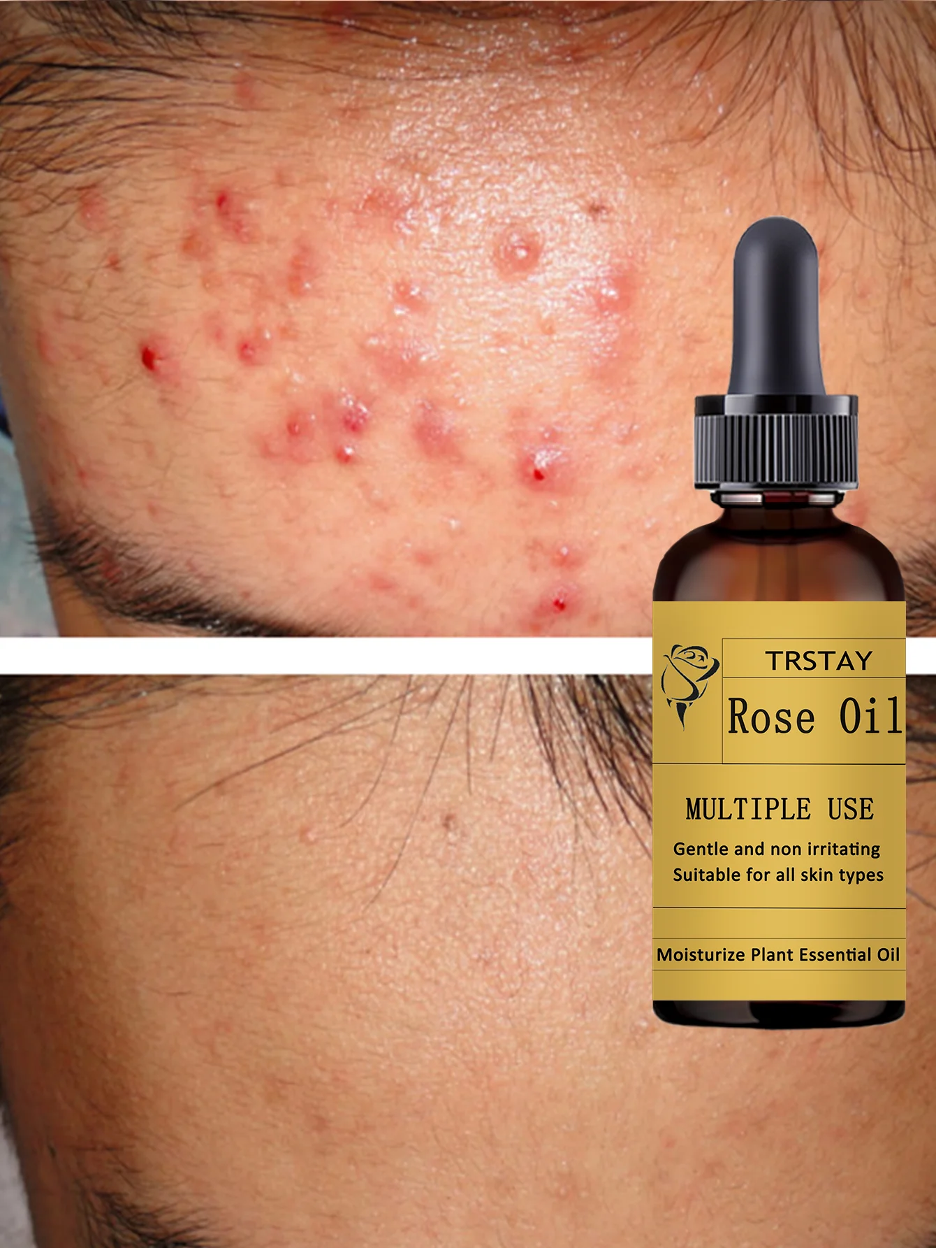 All-in-One Hydrating Serum for All Skin Types Fast-Absorbing Formula to Simplify Your Skincare Routine with Deep Moisture and No - Image 2