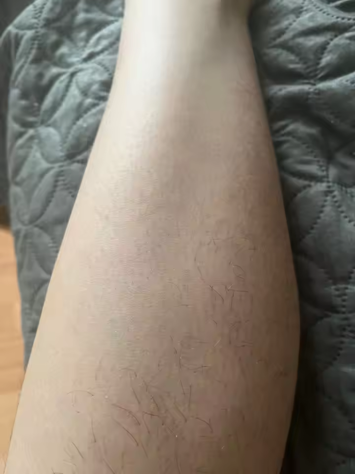 Resultado Lumëra - foto 2