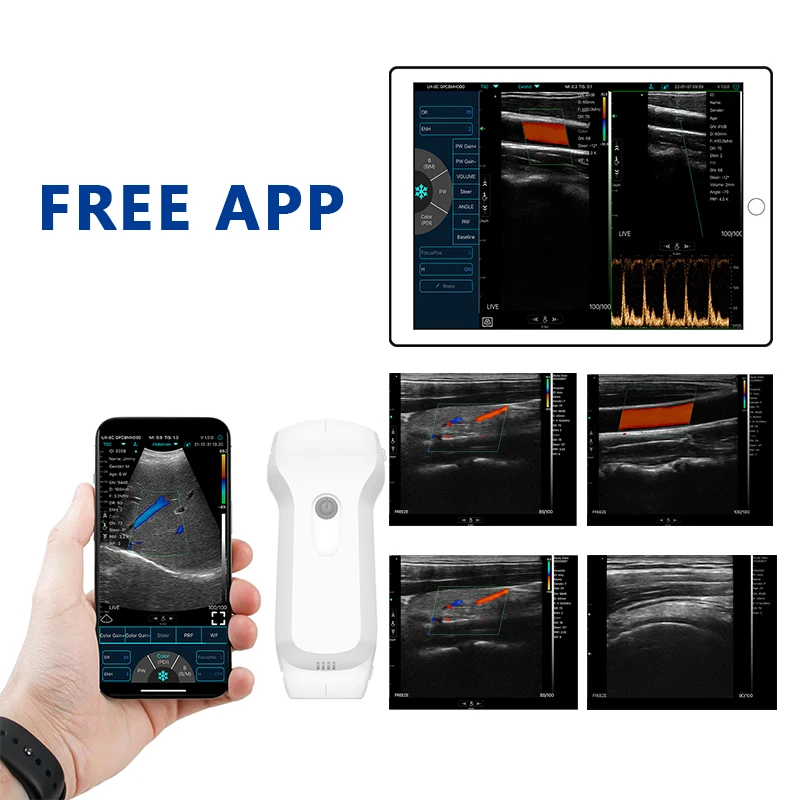 Medical Handheld Ultrasound scanner C10RL Dual Head 3 in 1 probe Portable Ultrasound Diagnostic System