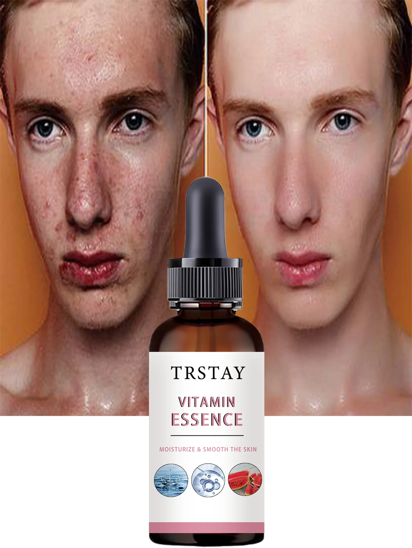 Hydrating Facial Oil Deep Nourishment Serum Relieves Dry Tightness for Smooth Glowing Skin Moisturizing Treatment with Natural I - Image 5