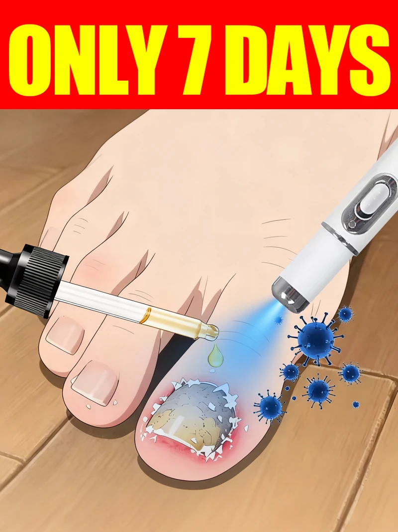 

Generation-2 Laser Says Goodbye To Bad Manicure fungus In 7 Days