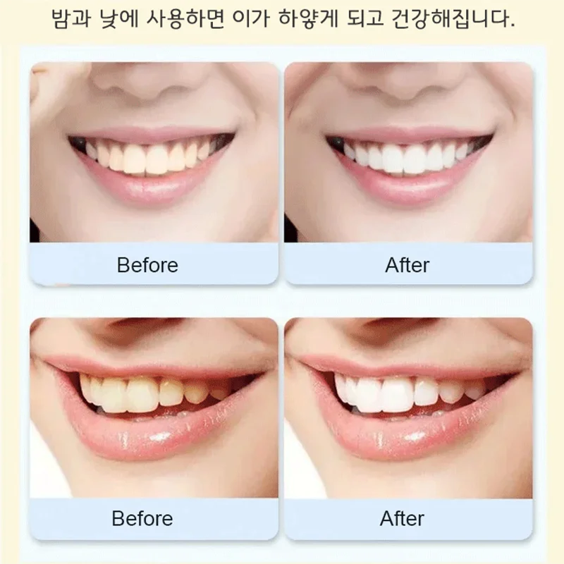 1/2/3pcs 프로바이오틱 치약 누렁니 미백 치약 딥 클리닝 치약 입냄새 제거/누렁니제거 120g 효소치약 프로바이오틱미백치약 치아미백