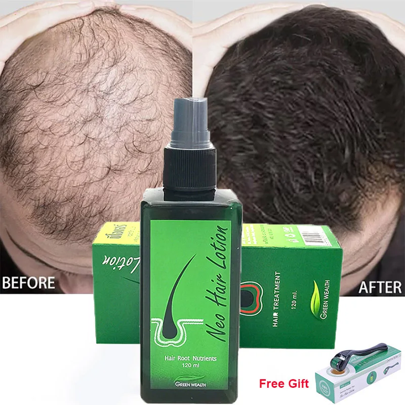 

Original Thailand 120ml Neo Hair Lotion Hair Root Beard Sideburns Longer 100% Herbs Hair Loss Nutrients Treatments Hair Regrowth