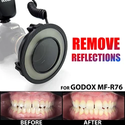 치과 사진. Godox MF-R76 편광 필터. 치과 사진 카메라 플래시 액세서리, 반사 및 눈부심 없음