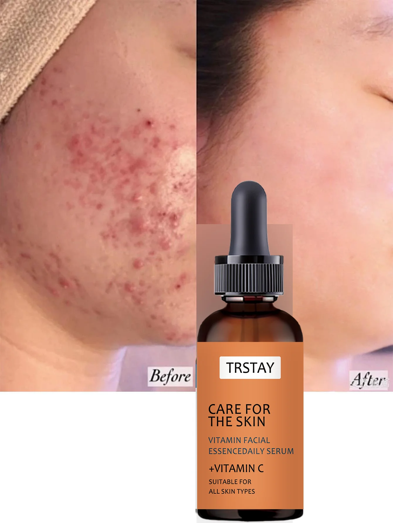 Hydrating Summer Weight Facial Oil Light Non Sticky Formula for Glowing Skin All Day Long with Natural Ingredients Perfect for D - Image 5