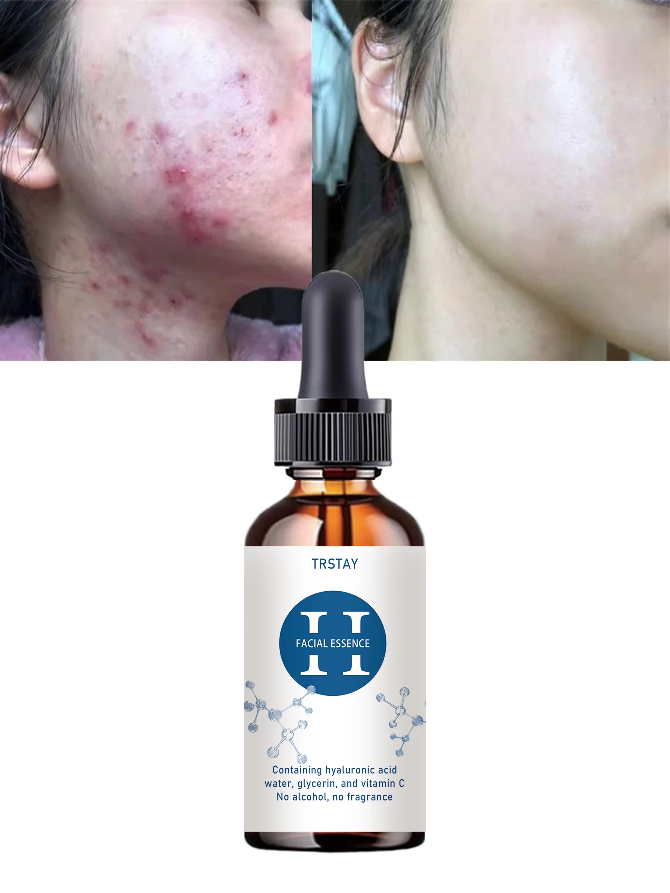 Moisturizing Natural Fragrance Scented Facial Oil for Relaxing Skin Treatment Tightening Serum to Enhance Skin Elasticity Radian - Image 6