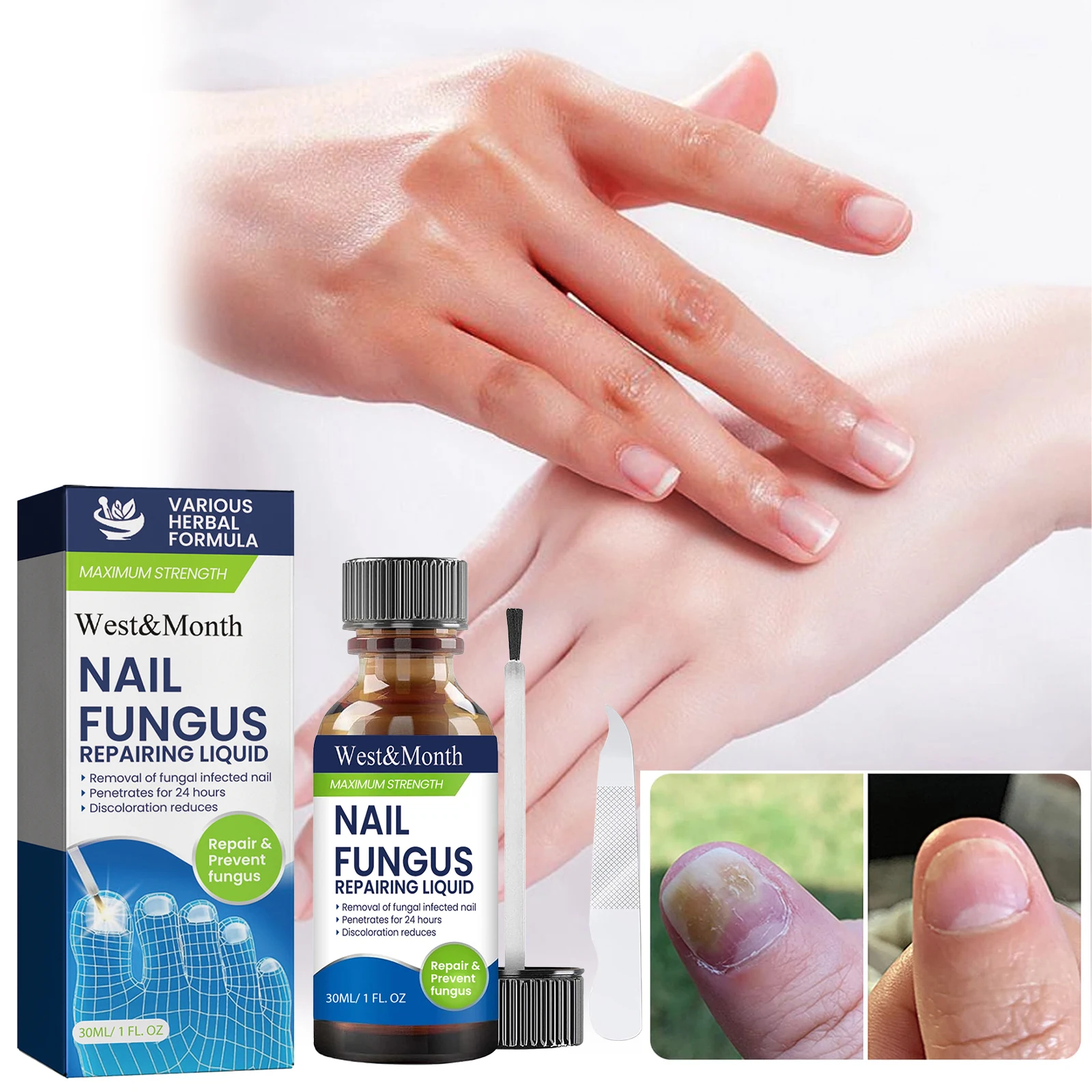 West&Month Nail Fungus Repair Liquido per la cura della pelle del piede delle mani Siero Rimuovi infettato Addensare Luminoso Fungine Trattare Morbida cura dei piedi delle mani