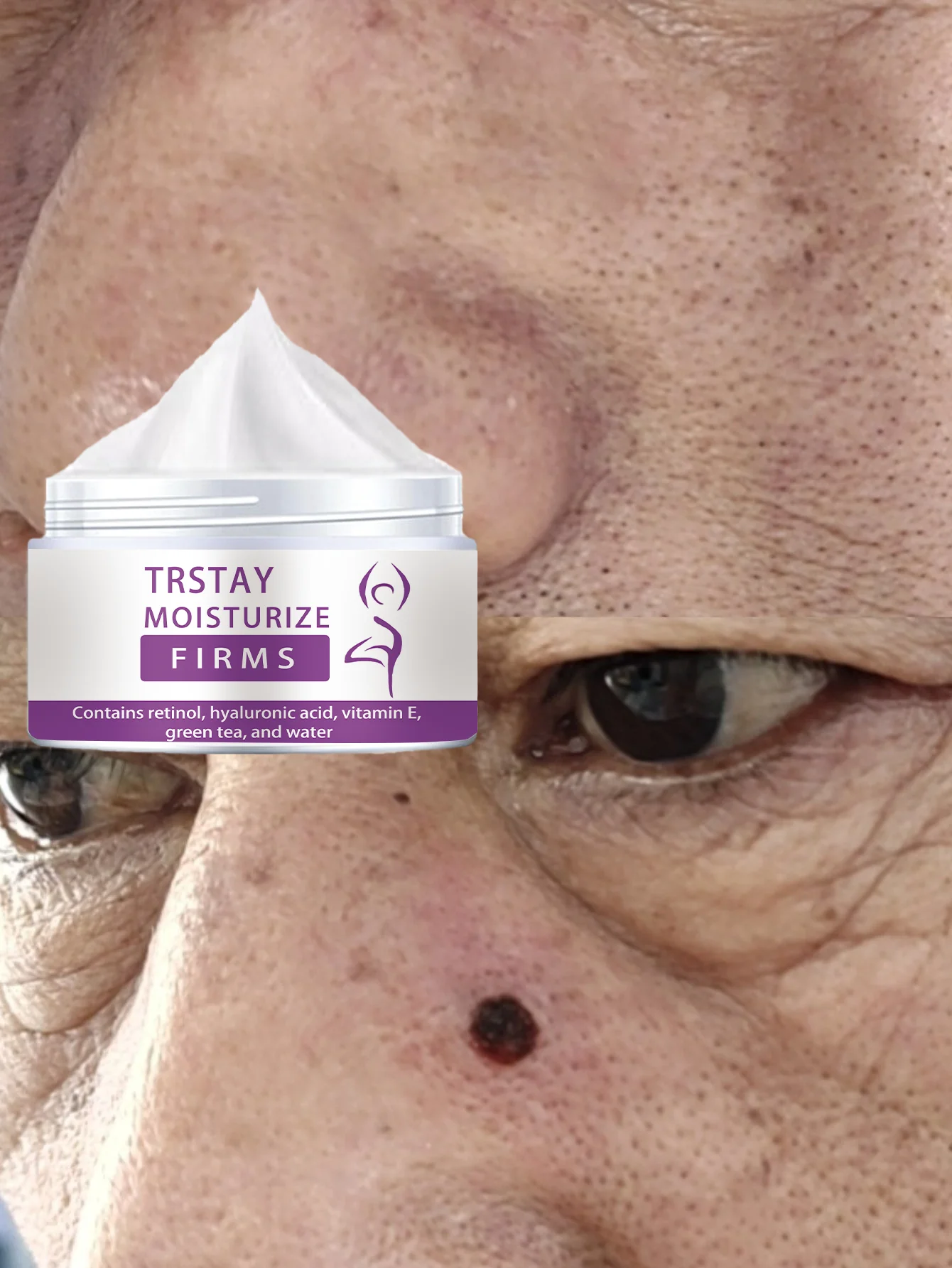 

Moisturizing neck care cream deeply smooth fine lines shrink large pores fade acne marks and spots for effective skin rejuvenati