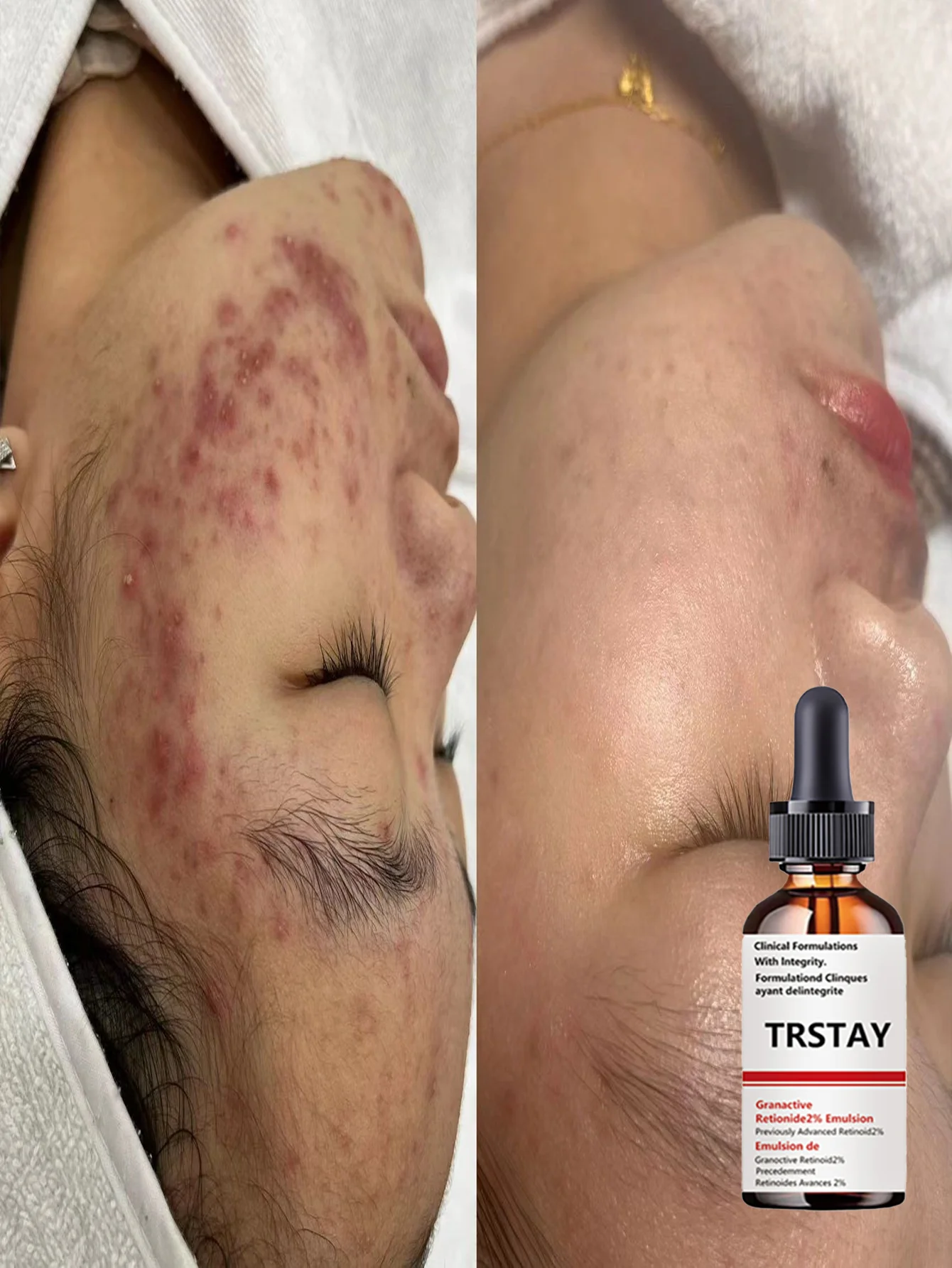 Hydrating Anti Aging Serum Brighten Complexion Reduce Wrinkles Smooth Texture Even Tone Revitalize Glow Multi Effect Repair Esse - Image 5