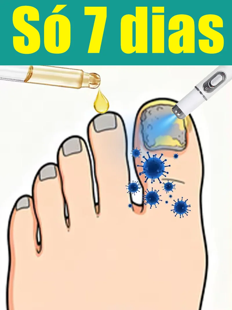 

Eliminação de problemas nas unhas