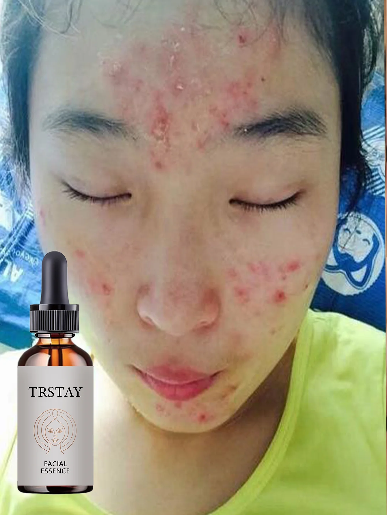 Hydrating Facial Oil Quick Absorption No Shine Lightweight Non Greasy Formula for All Skin Types Deep Moisturizing Serum with Na - Image 5