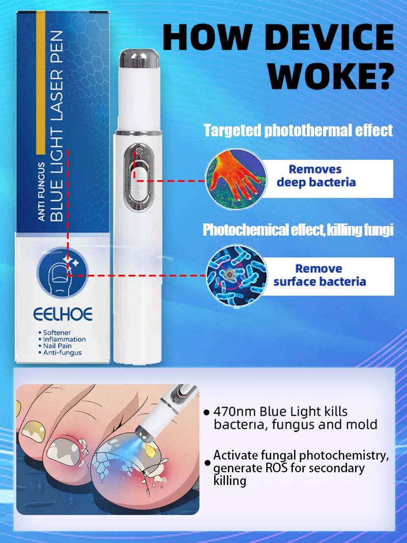 Hot Sellers 2025: nagelreinigingsgereedschap, blauwlichtlasertools Wortelreparatie Opgewaardeerd naar de tweede generatie