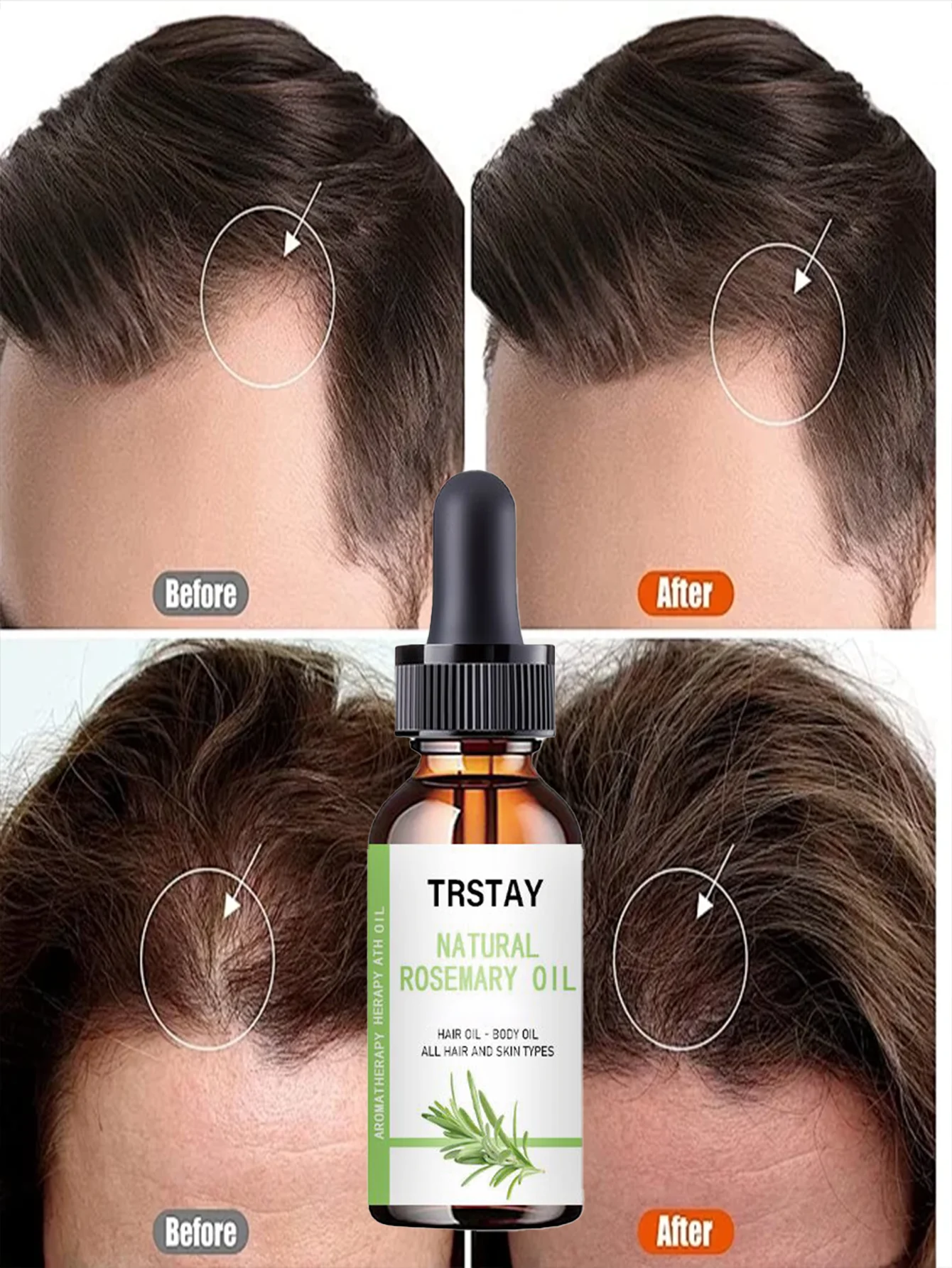 Professional Hair Treatment Oils for Nourishing Growth Tame Dry Hair Develop Smooth Style Various Specs All Hair Types Moisturiz - Image 5