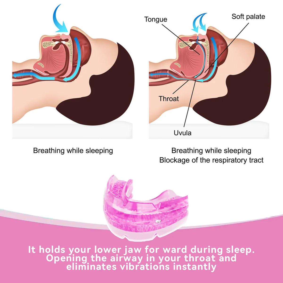 Adjustable Anti Snore Mouthpiece BPA Free Sleep Aid Device with Screw Adjustment Design Comfortable Dental Guard for Adults Reusable Snoring Relief Oral Appliance Lower Jaw Support Night Mouth Guard with Storage Case Portable Teeth Care Tool for Better Sl