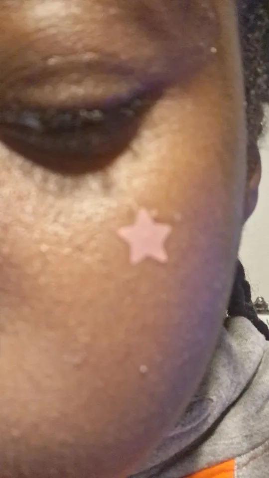Customer review photo