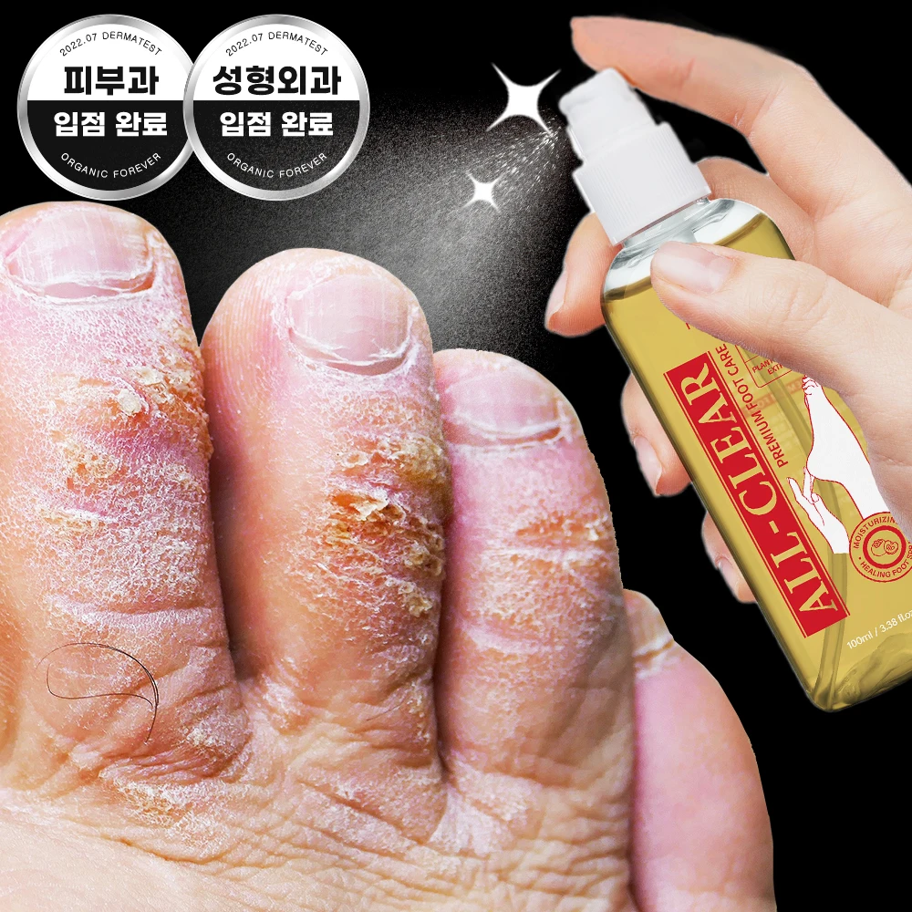 [Special Limited Sale Offer] Mediorga All Clear Foot Mist – Complete Care for Fungal Infections, Foot Odor, and Calluses