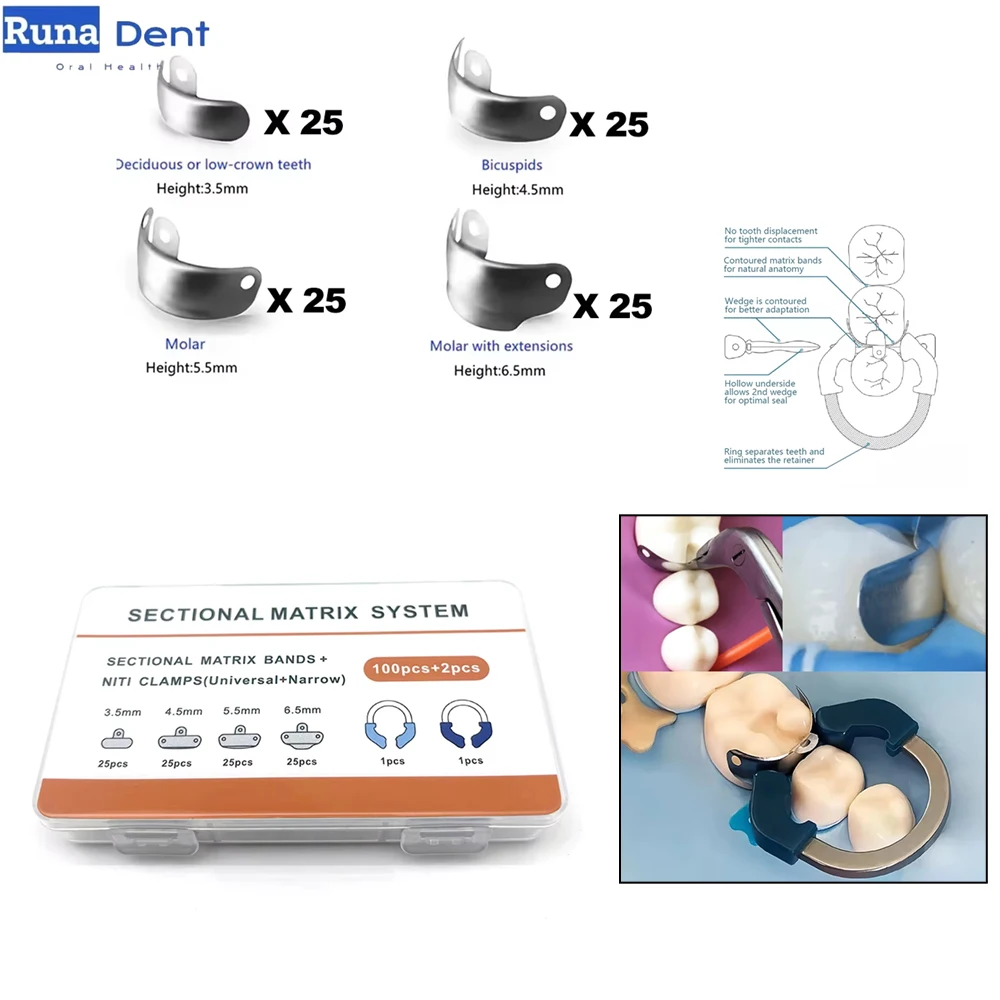 

102PCS Dental Matrix Kit NiTi Clamp Rings Metal Bands for Molar Filling Contour Sectional Restoration Dental Lab Supplies