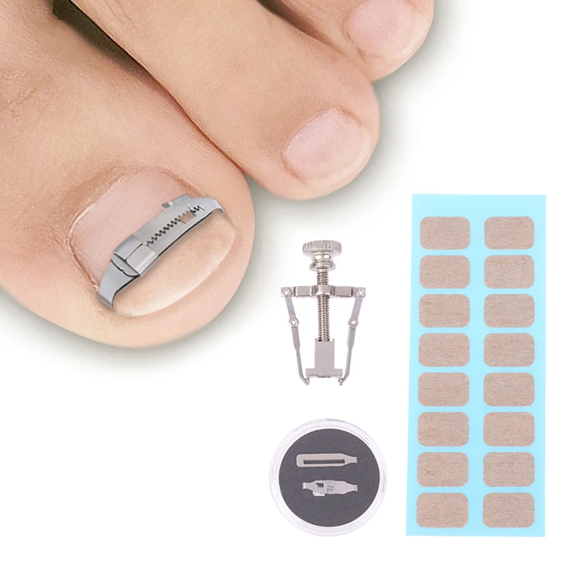 Ingrown Toenail Corrector Tools Pedicure Recover Embed Toe Nail Treatment Professional Foot Care Correction Tool Care Foot