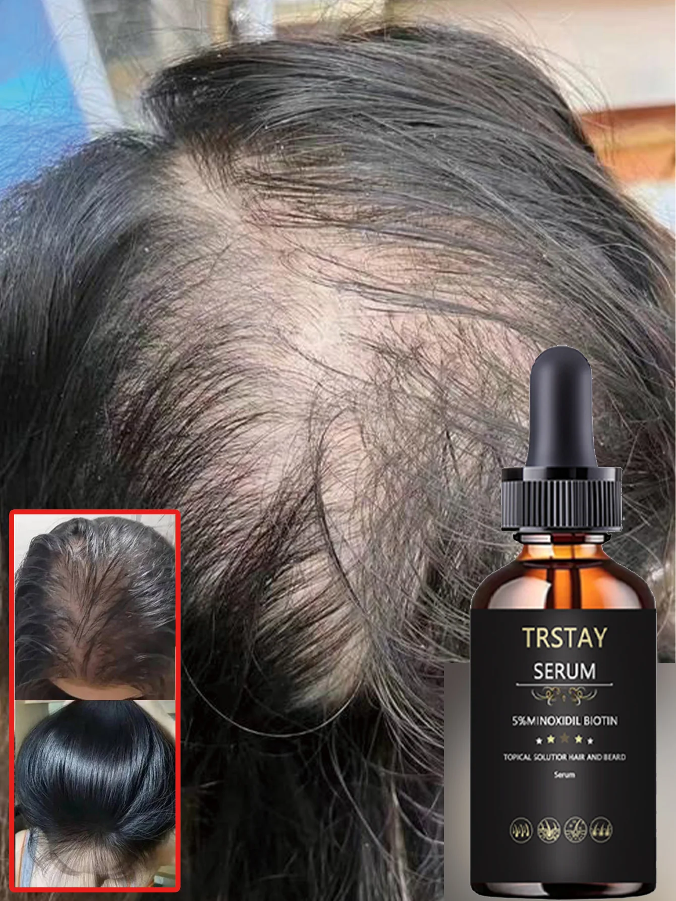 زيت عطري مرطب يعزز الشعر ويحسن مرونة الشعر وترطيب الشعر الناعم ويبدو أكثر سمكًا، محلول العناية بالشعر الطبيعي