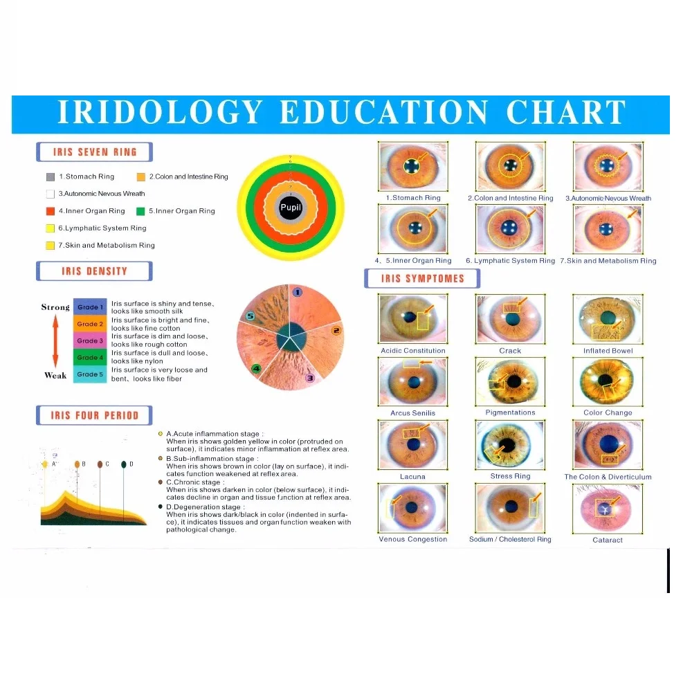 Portable 12MP Iris Analyzer Iridology Iriscope Camera for Body Health Diagnosis with English software