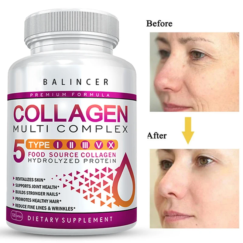Collagen Complex – Nutritional Supplement That Helps Whiten & Brighten Skin, Joints, Nails, Hair Support, and Relieve Fine Lines